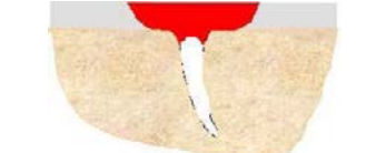 図2 浸透探傷試験の原理
